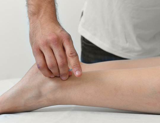 דיקור בקרסול